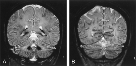 Fig 2.