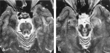 Fig 3.