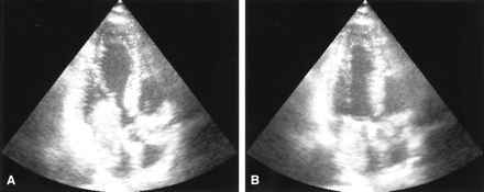 Fig 2.
