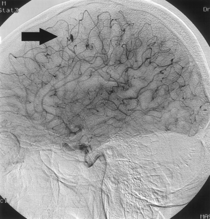 Fig 3.