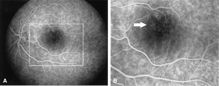 Fig 4.
