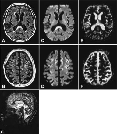 Fig 2.