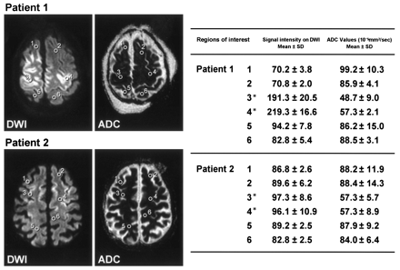 Fig 3.