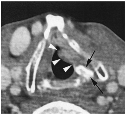 Fig 1.