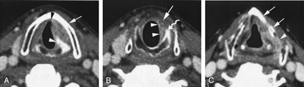 Fig 2.