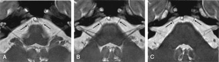 Fig 1.