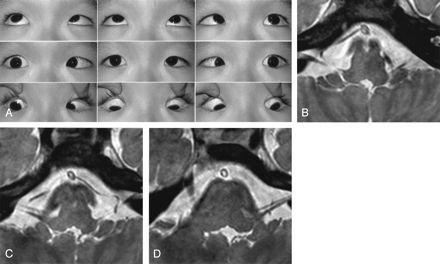 Fig 3.
