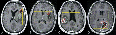 Fig 2.