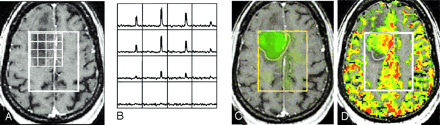 Fig 3.