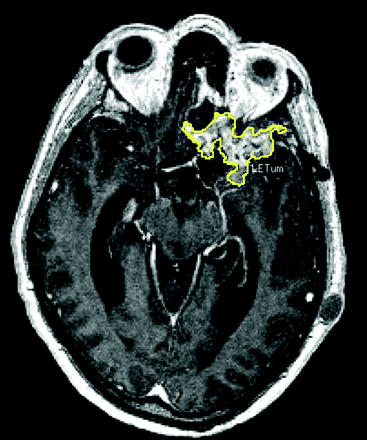 Fig 1.