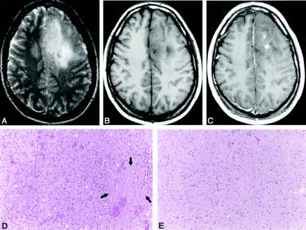 Fig 1.