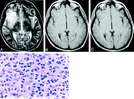 Fig 2.