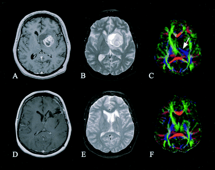 Fig 2.