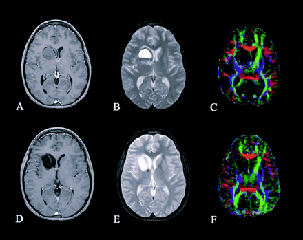Fig 4.