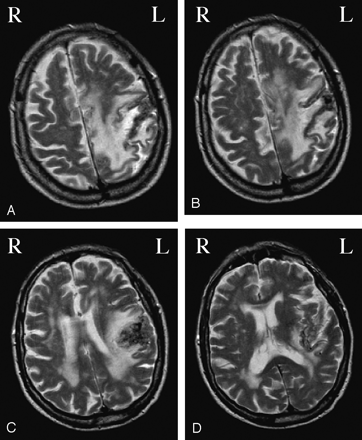 Fig 1.