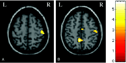 Fig 3.
