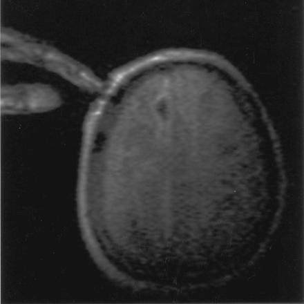 Fig 1.
