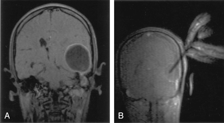 Fig 2.
