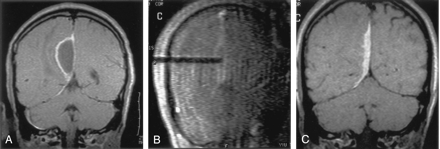 Fig 3.