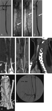 Fig 2.