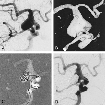 Fig 2.