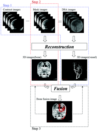 Fig 1.