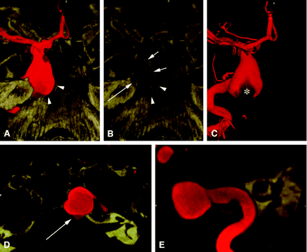 Fig 2.