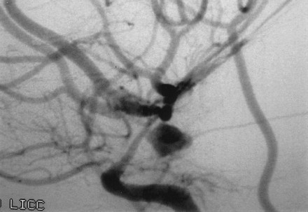 Fig 1.