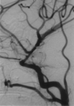 Fig 2.