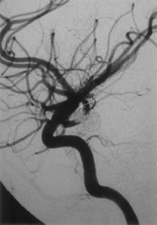 Fig 3.