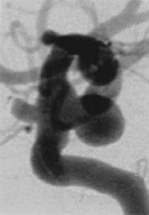 Fig 4.