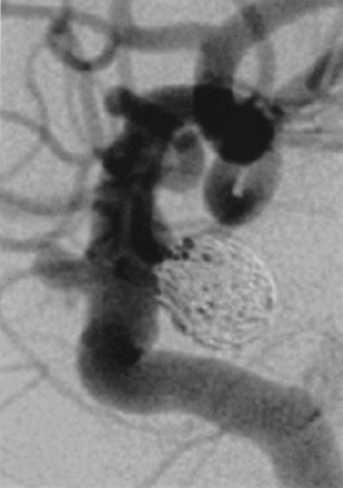 Fig 5.