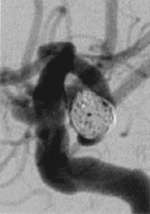 Fig 6.