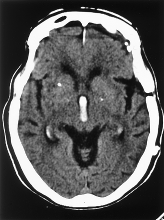 Fig 2.