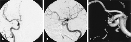 Fig 4.