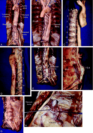 Fig 1.