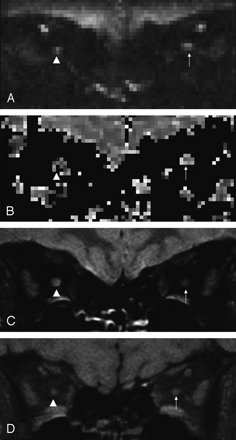 Fig 1.