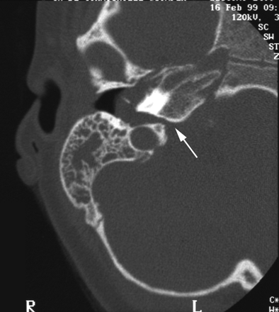 Fig 1.