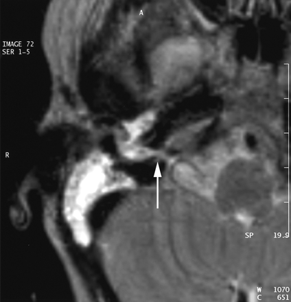 Fig 3.