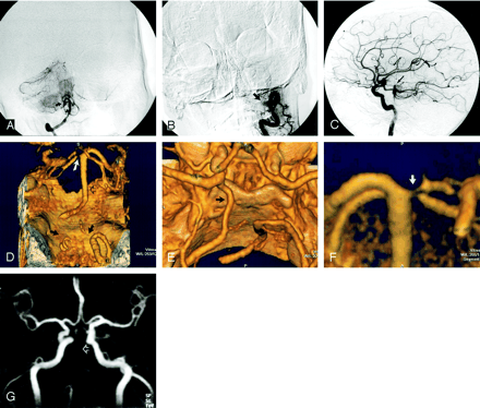 Fig 3.