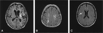 Fig 3.