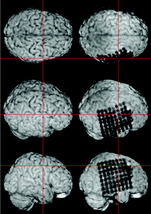 Fig 2.