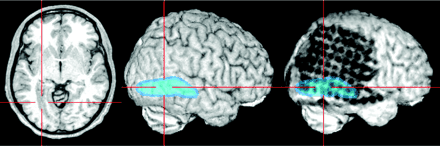 Fig 4.