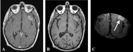 Fig 1.