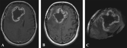 Fig 2.