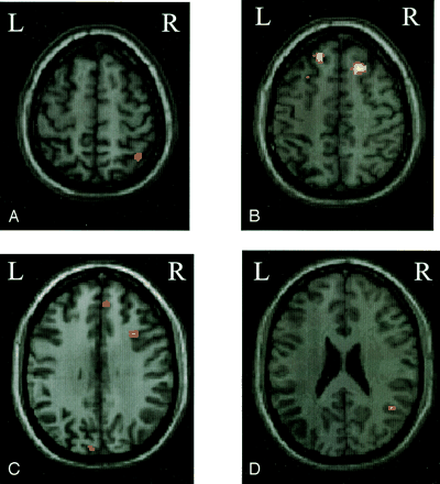 Fig 2.