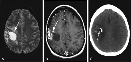 Fig 1.