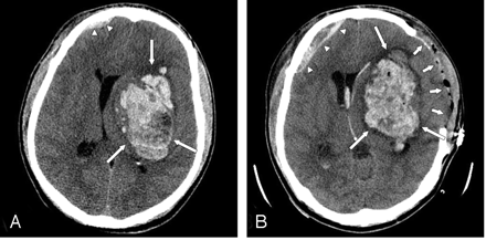 Fig 1.