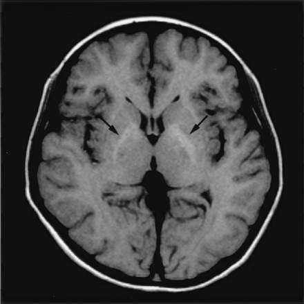 Fig 1.