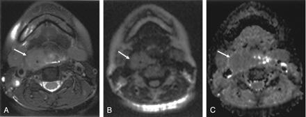 Fig 1.